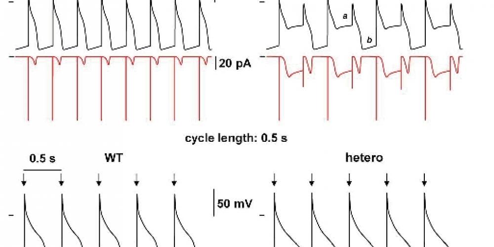 Comparaisons entre électrocardiogrammes réels et simulations.